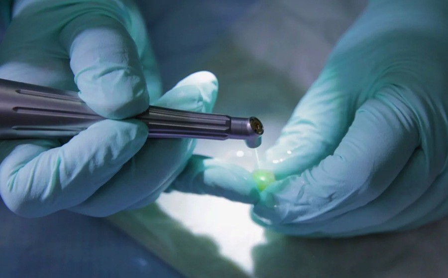 The Role of Lasers in Medicine: A Comprehensive Overview